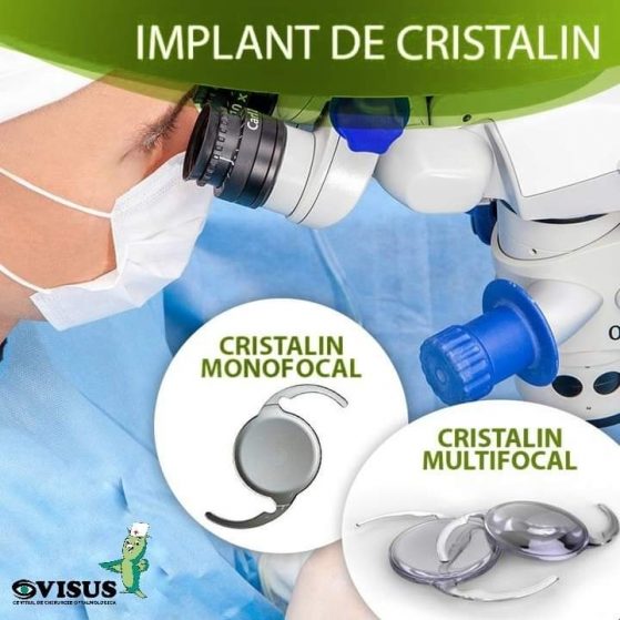 ❗Există 2 tipuri principale de cristalin intraocular artificial: #monofocal și #multifocal.