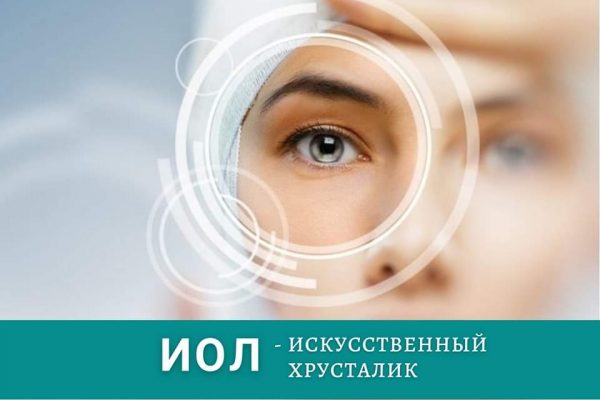 Интраокулярная линза (ИОЛ)